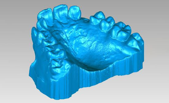 齿科3D打印